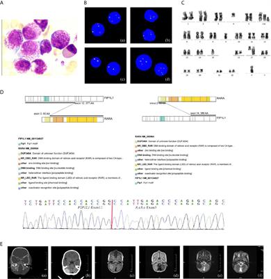 Myeloid Sarcoma Type of Acute Promyelocytic Leukemia With a Cryptic Insertion of RARA Into FIP1L1: The Clinical Utility of NGS and Bioinformatic Analyses